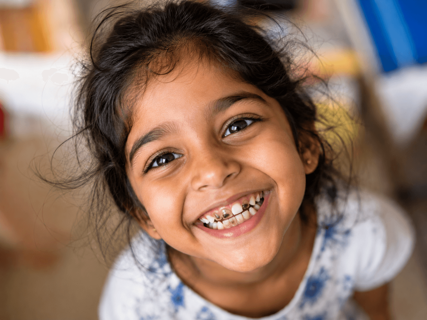 Kids Dentistry — before treatment